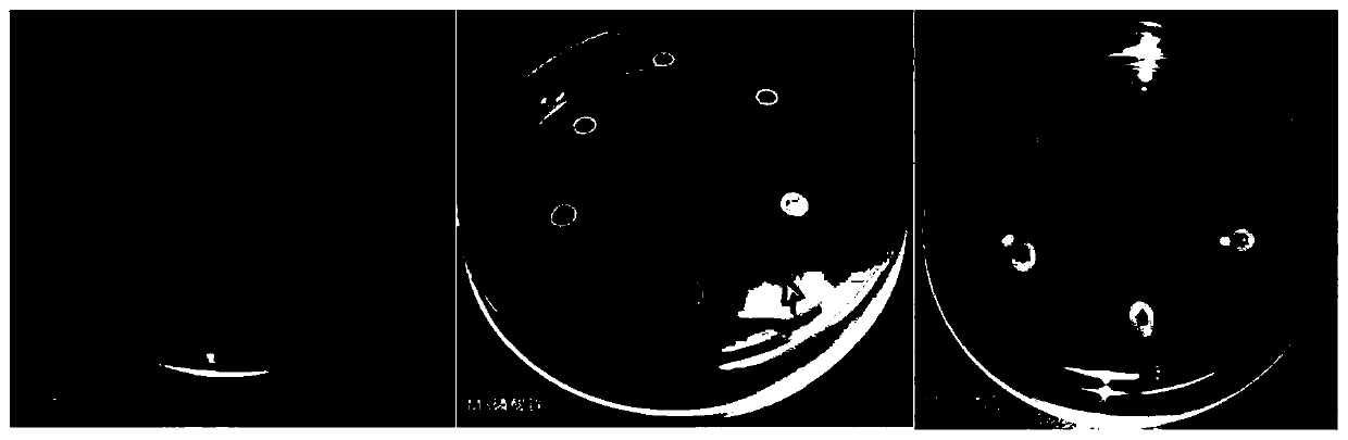 Intermediate rhizobium strain with phosphorus-dissolving property and application thereof