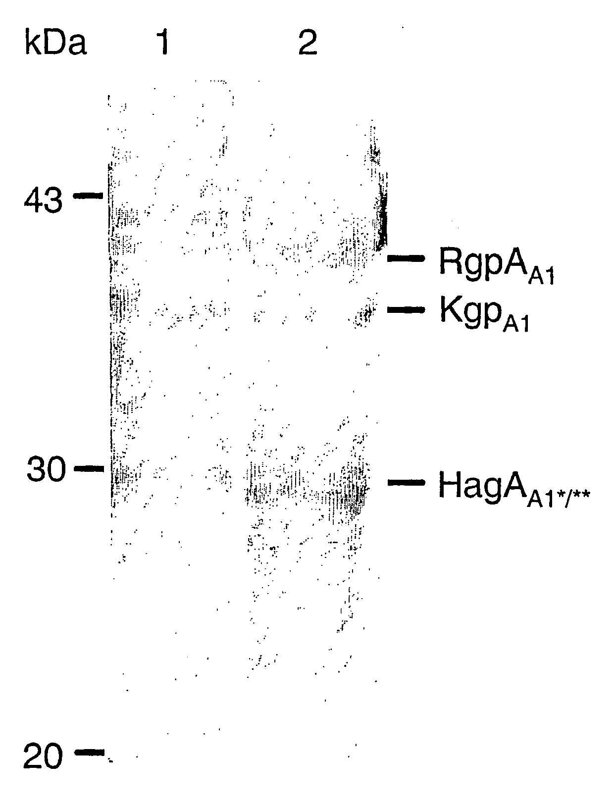 Antigenic Complex for the Diagnosis and Treatment of Porphyromonas Gingivalis Infection