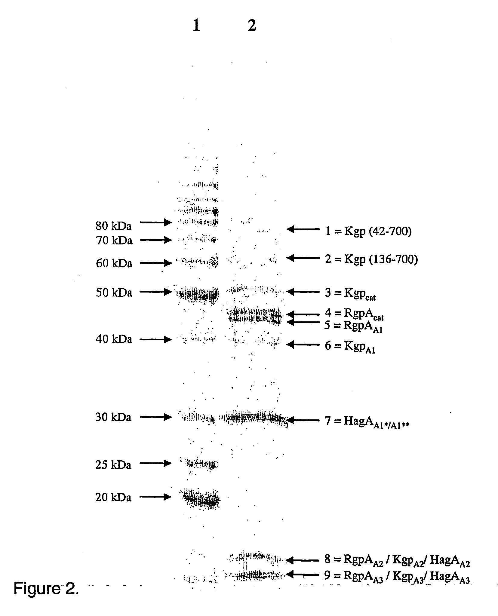 Antigenic Complex for the Diagnosis and Treatment of Porphyromonas Gingivalis Infection