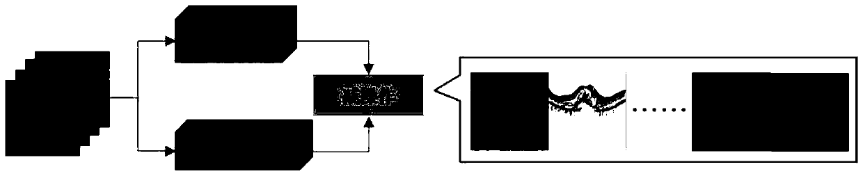 Method and system for segmenting choroidal neovascularization from fundus OCT image