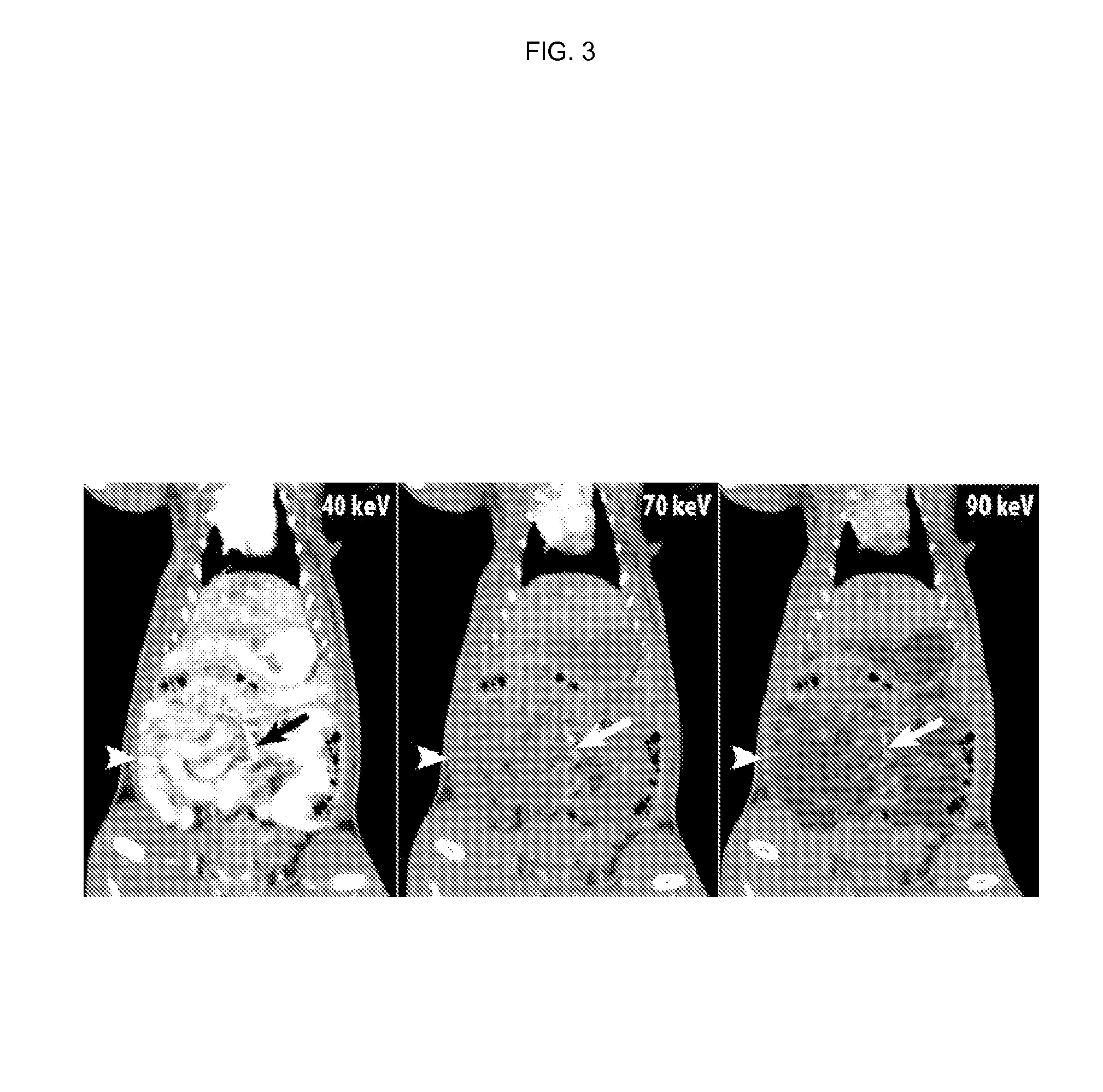 Silicone-based enteric CT contrast material