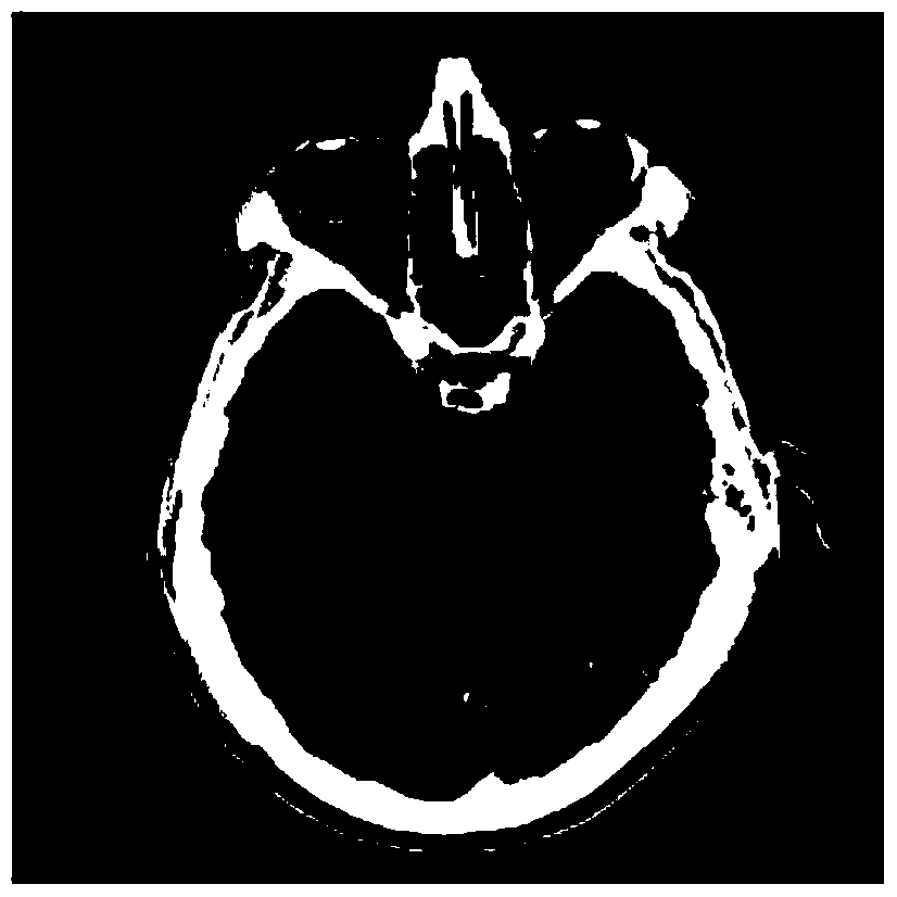 Embedding and extraction method of medical image zero watermark based on real fractional Fourier transform