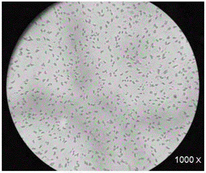 Efficient denitrification novel Acinetobacter and application thereof