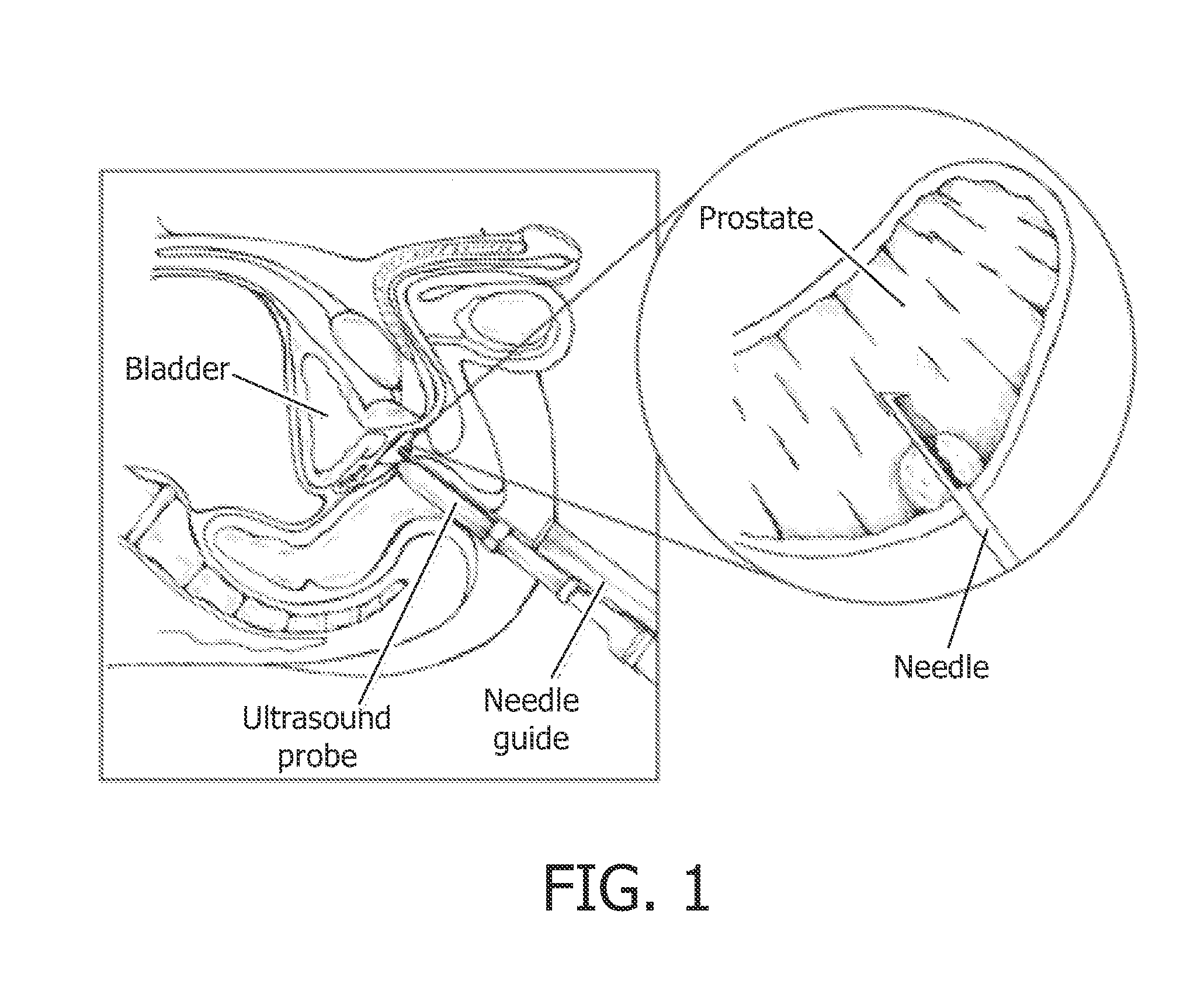 Biopsy guidance by image-based x-ray guidance system and photonic needle