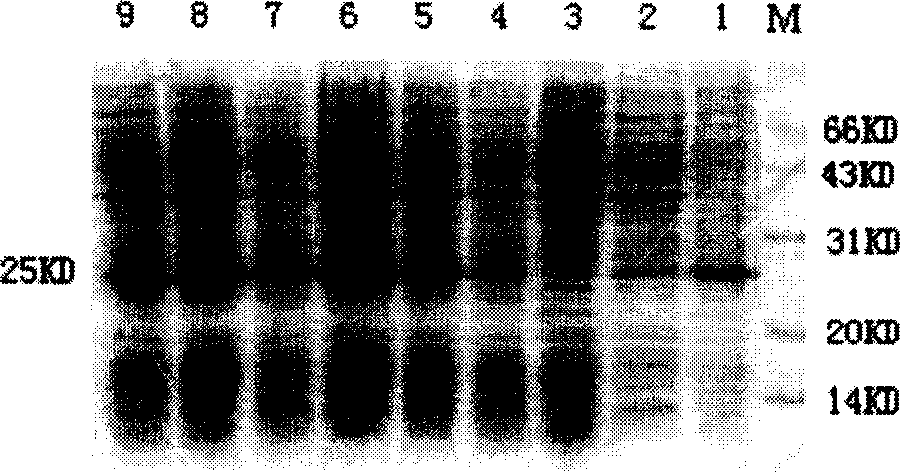 Adiponectin-Glucagon-like peptide-1-like peptide  recombinant protein expression vector and construction