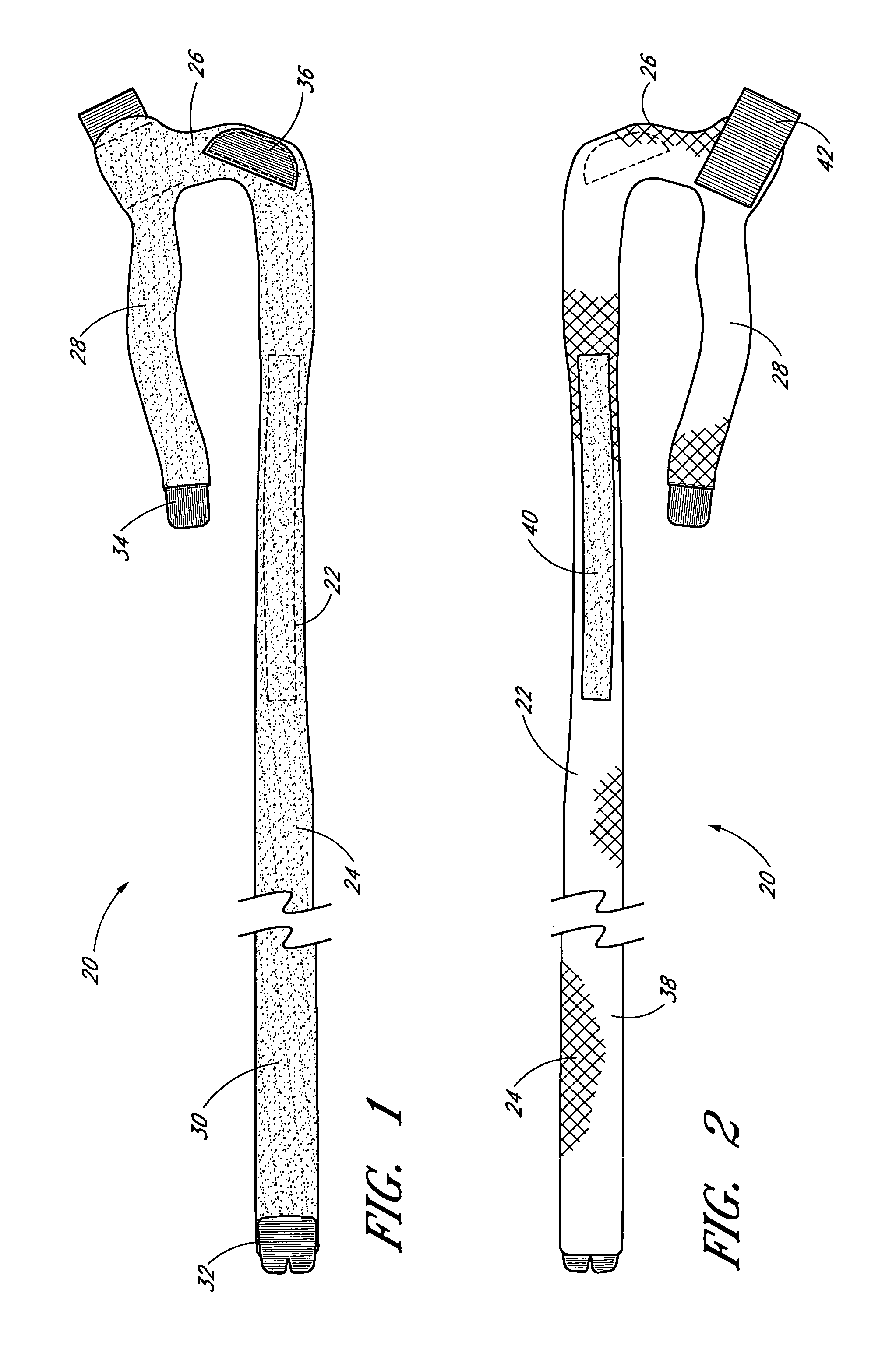 Device and method for externally rotating the femur