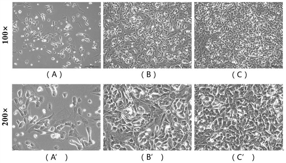 A Human Ewing Sarcoma Cell Line