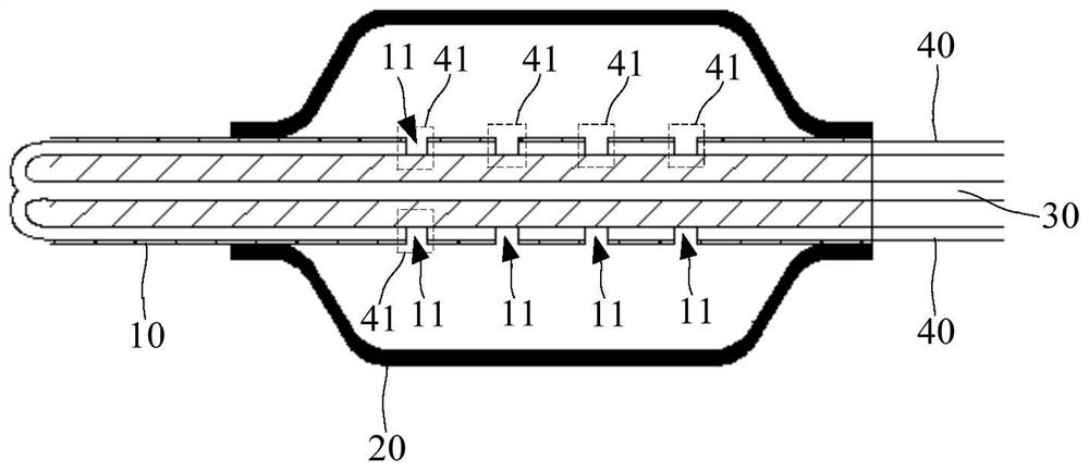 Pressure wave balloon catheter