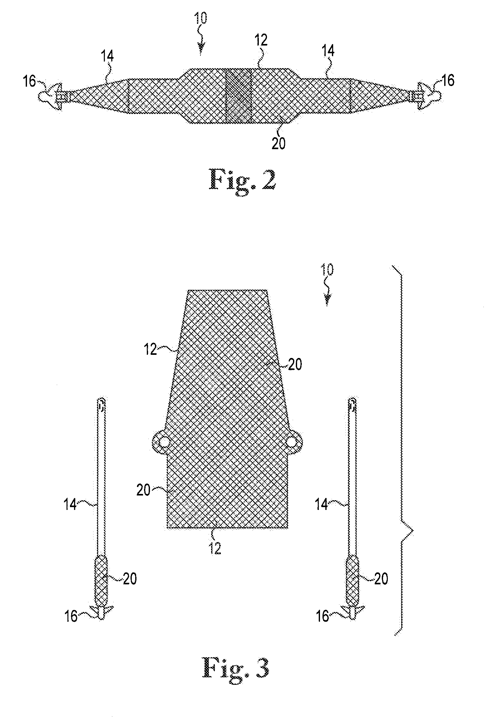 Coated Pelvic Implant Device and Method