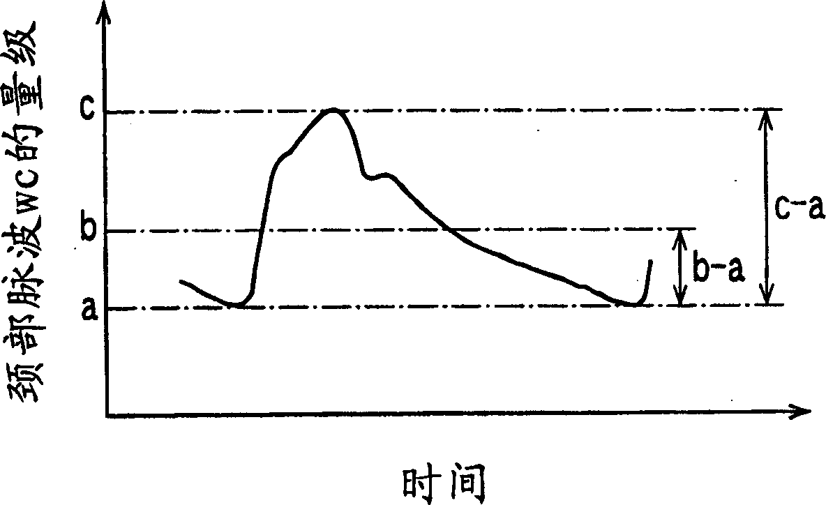 Blood pressure determining apparatus