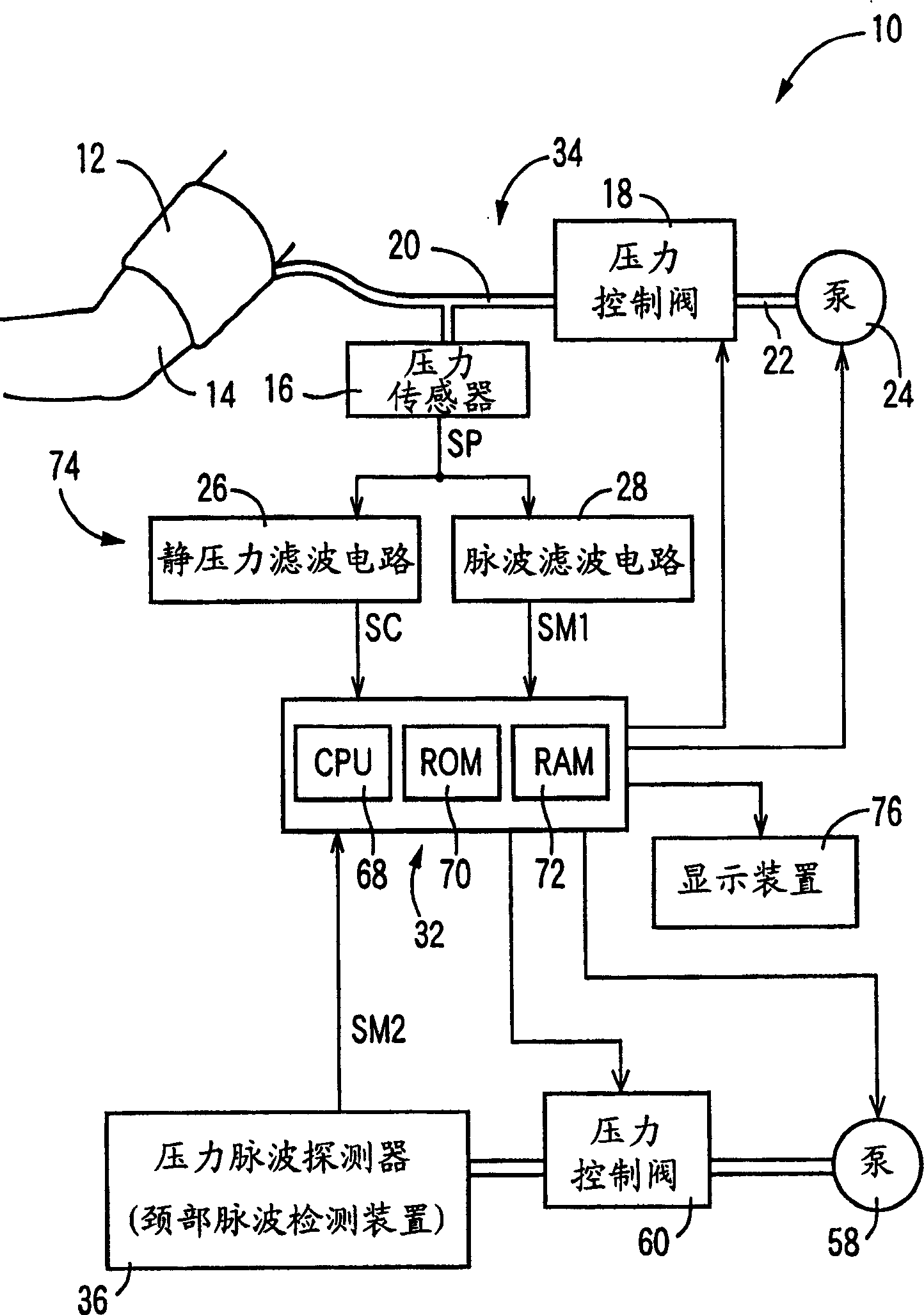 Blood pressure determining apparatus