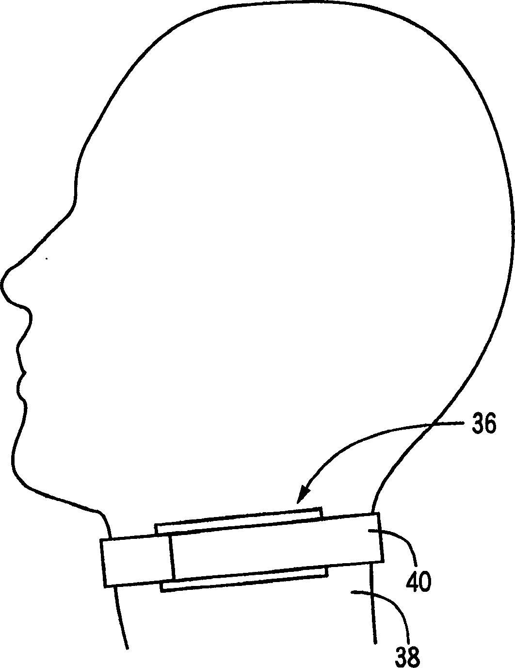 Blood pressure determining apparatus