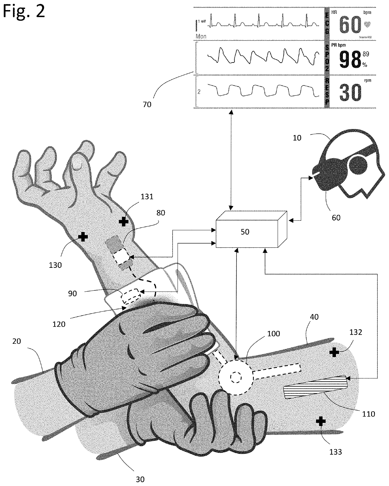 Multisensory Wound Simulation