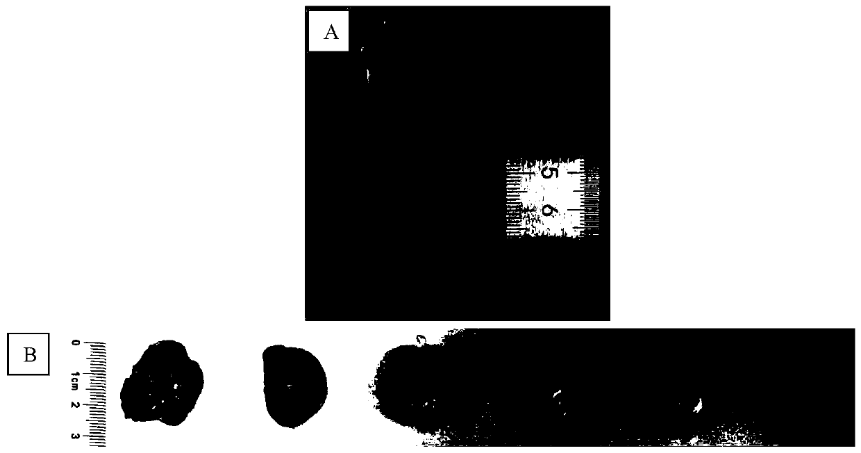 Human hemangioma animal model and high-success-ratio construction method thereof