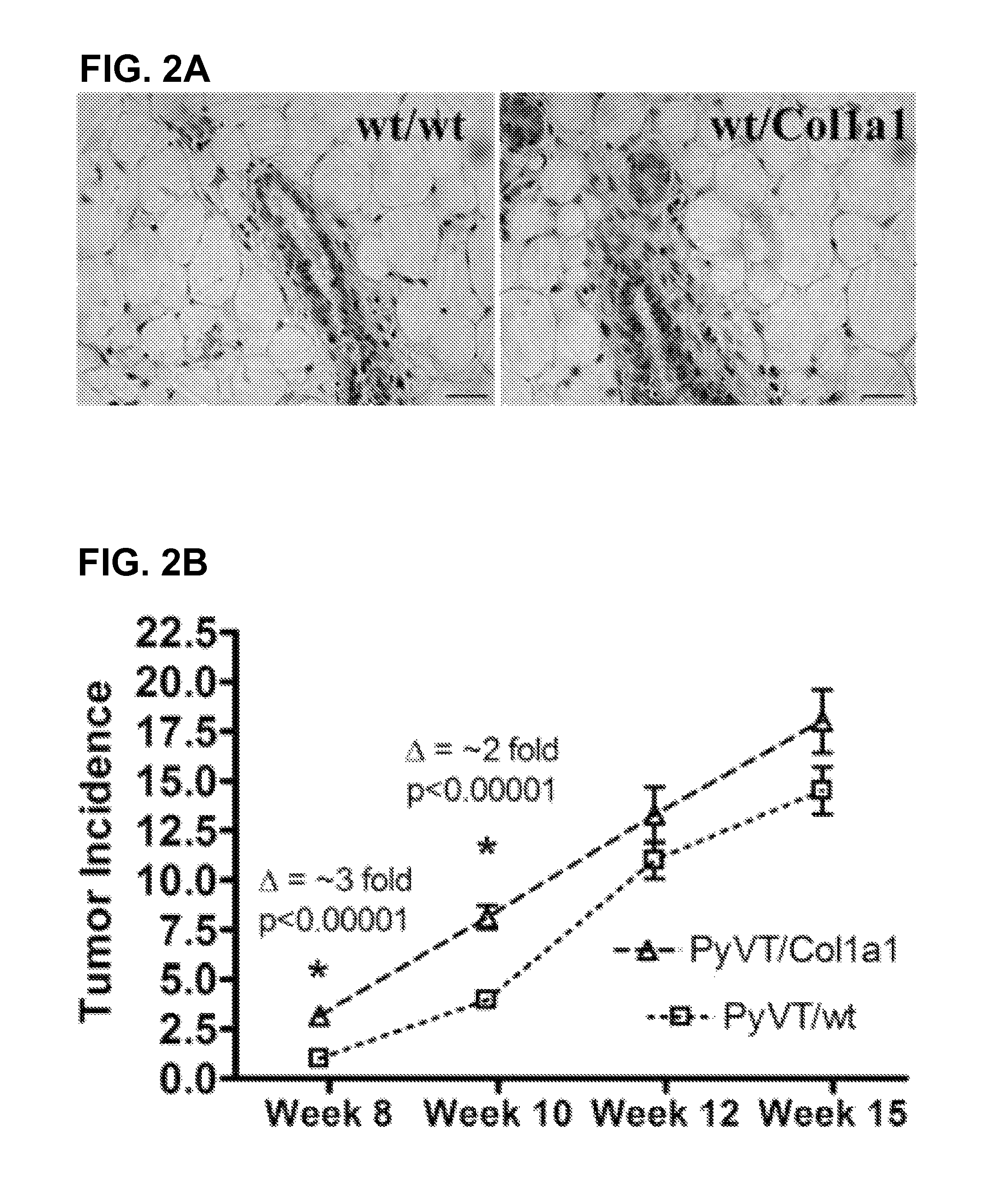 Use of endogenous fluorescence to identify invading metastatic breast tumor cells