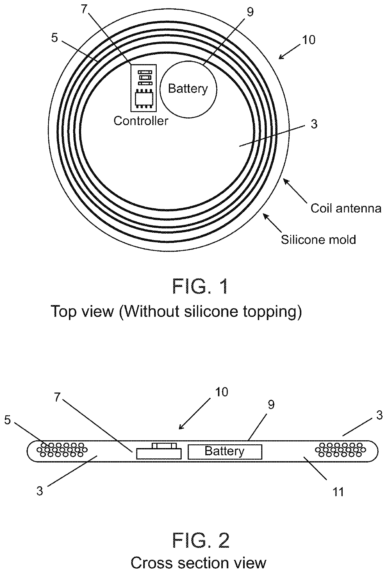 External electronic patch for accelerating bone healing or regeneration after trauma