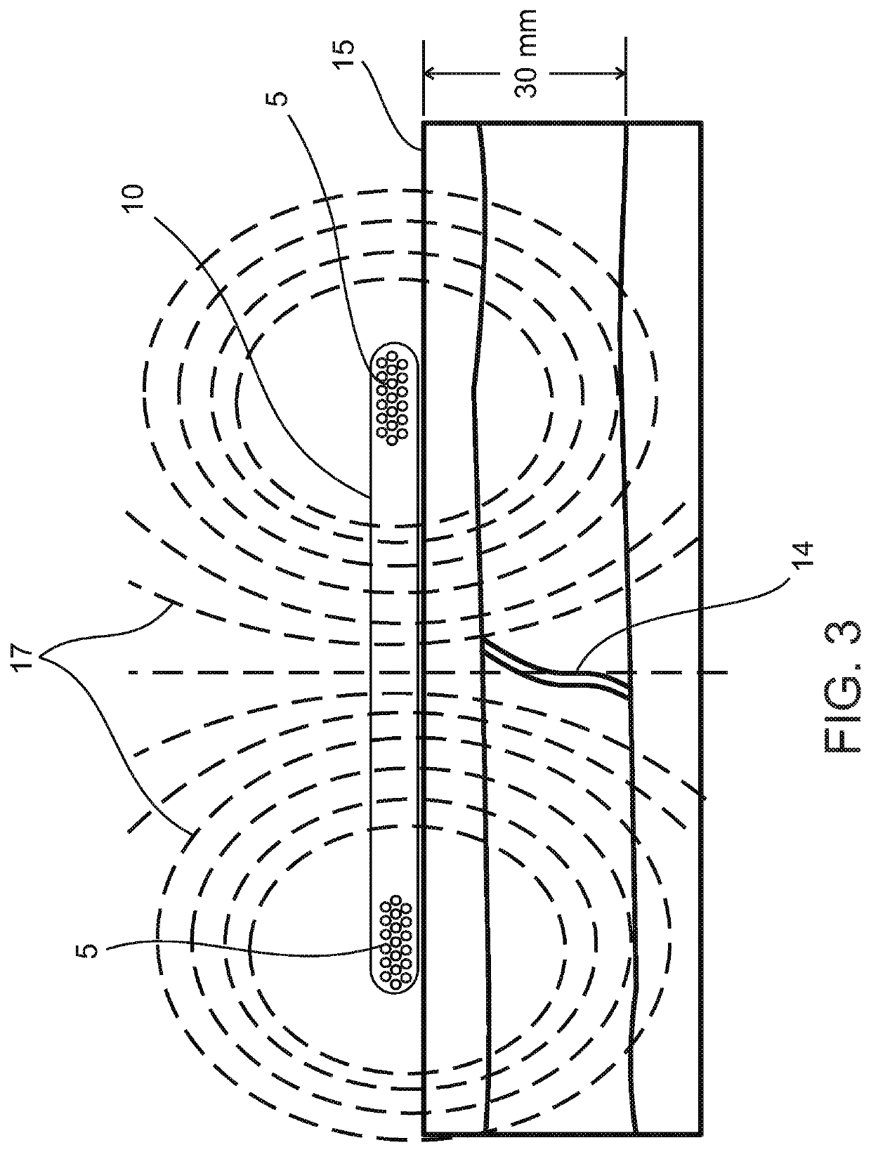 External electronic patch for accelerating bone healing or regeneration after trauma