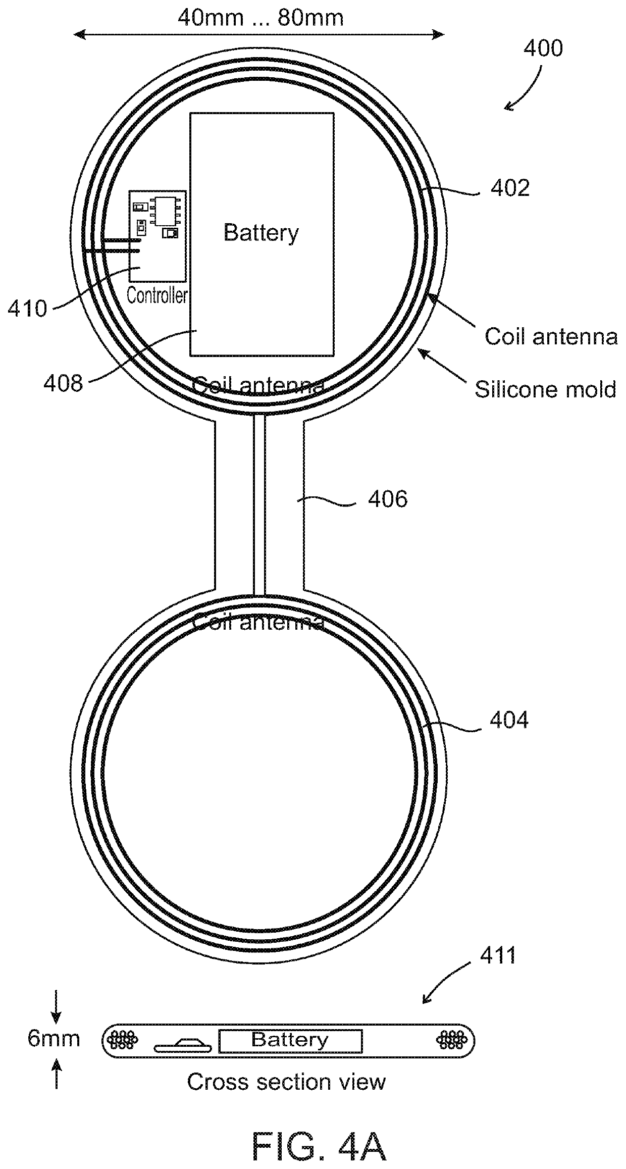 External electronic patch for accelerating bone healing or regeneration after trauma