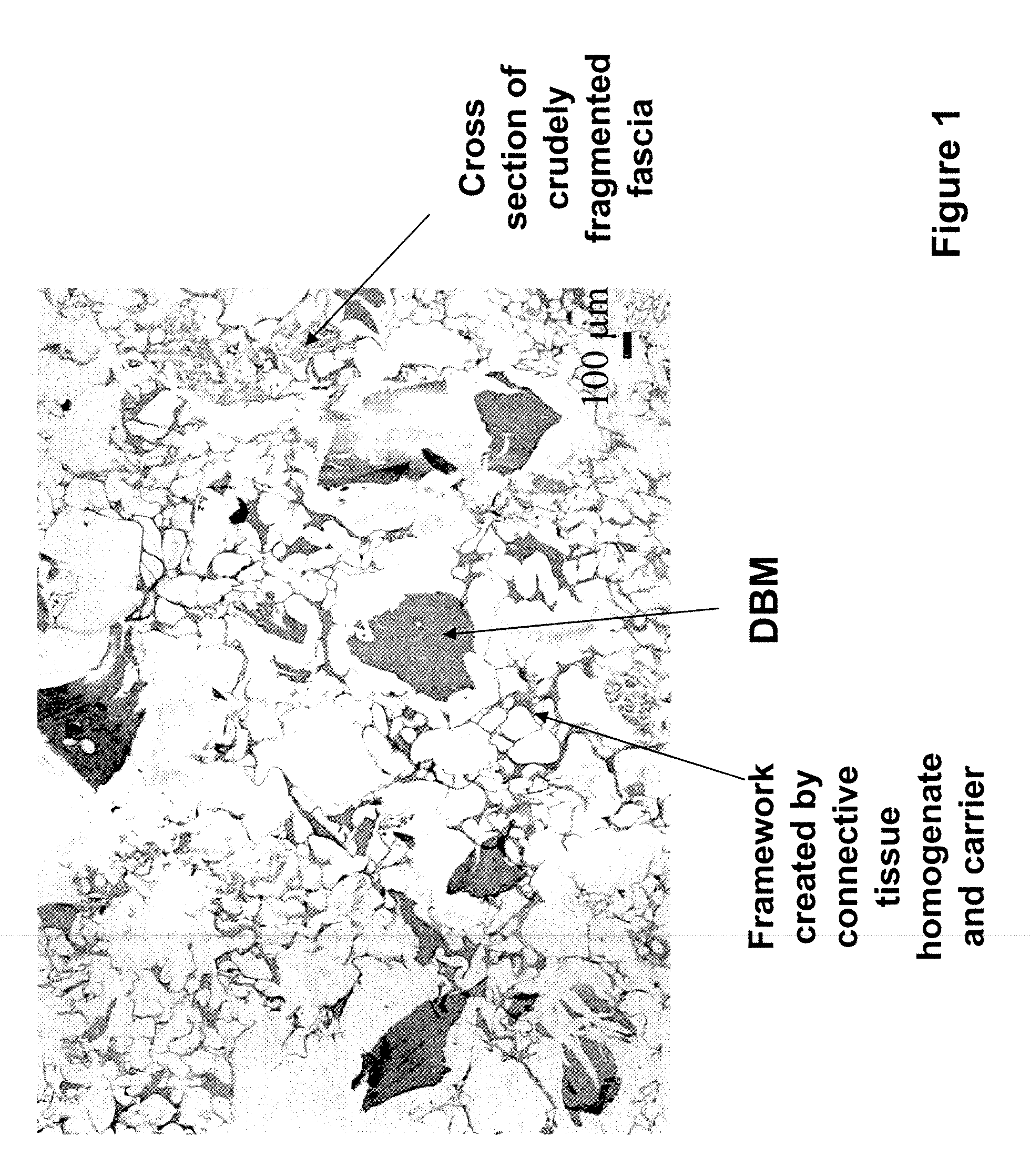 Composition for a tissue repair implant and methods of making the same