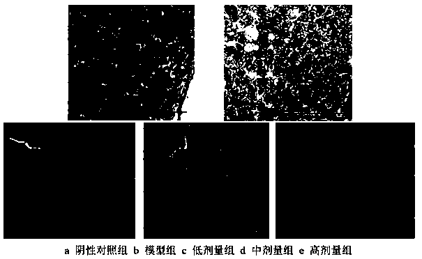 Application of black raspberry anthocyanin in preparing anti-liver-injury drugs or health food