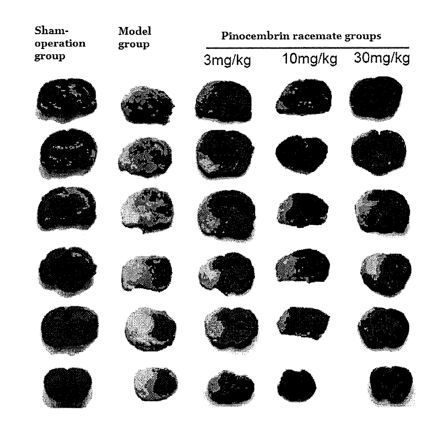 Use of racemates of pinocembrin in preparing medicaments for treating stroke