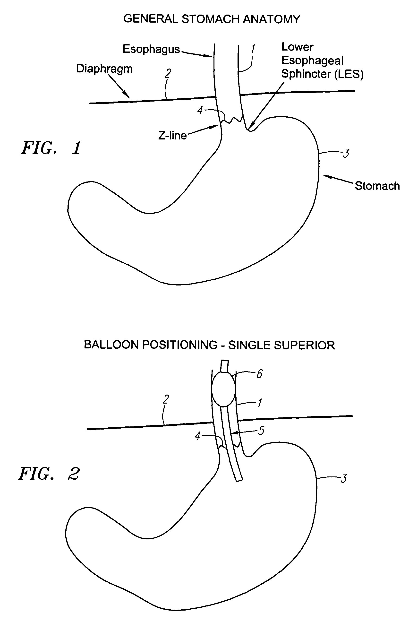 Methods and apparatus for treatment of obesity with an ultrasound device movable in two or three axes