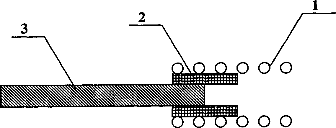 Removable spring ring for treating angioma