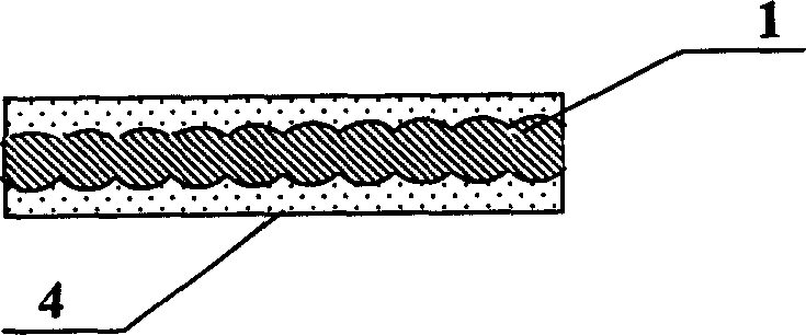 Removable spring ring for treating angioma