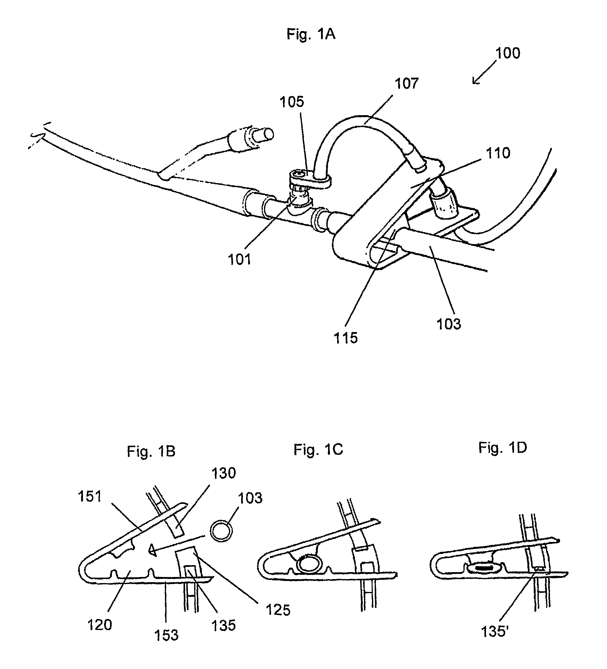 Intra-abdominal pressure monitoring system