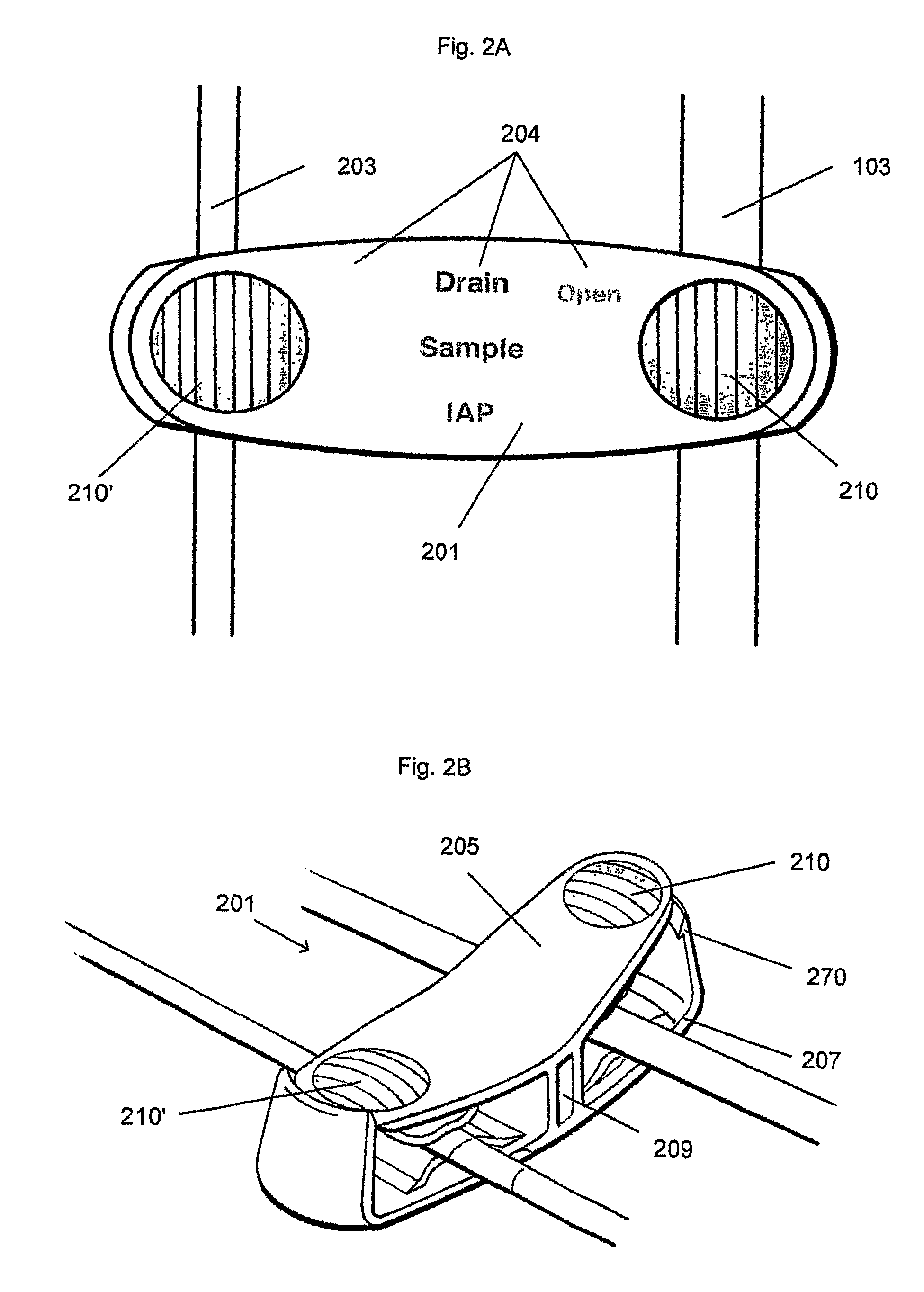 Intra-abdominal pressure monitoring system