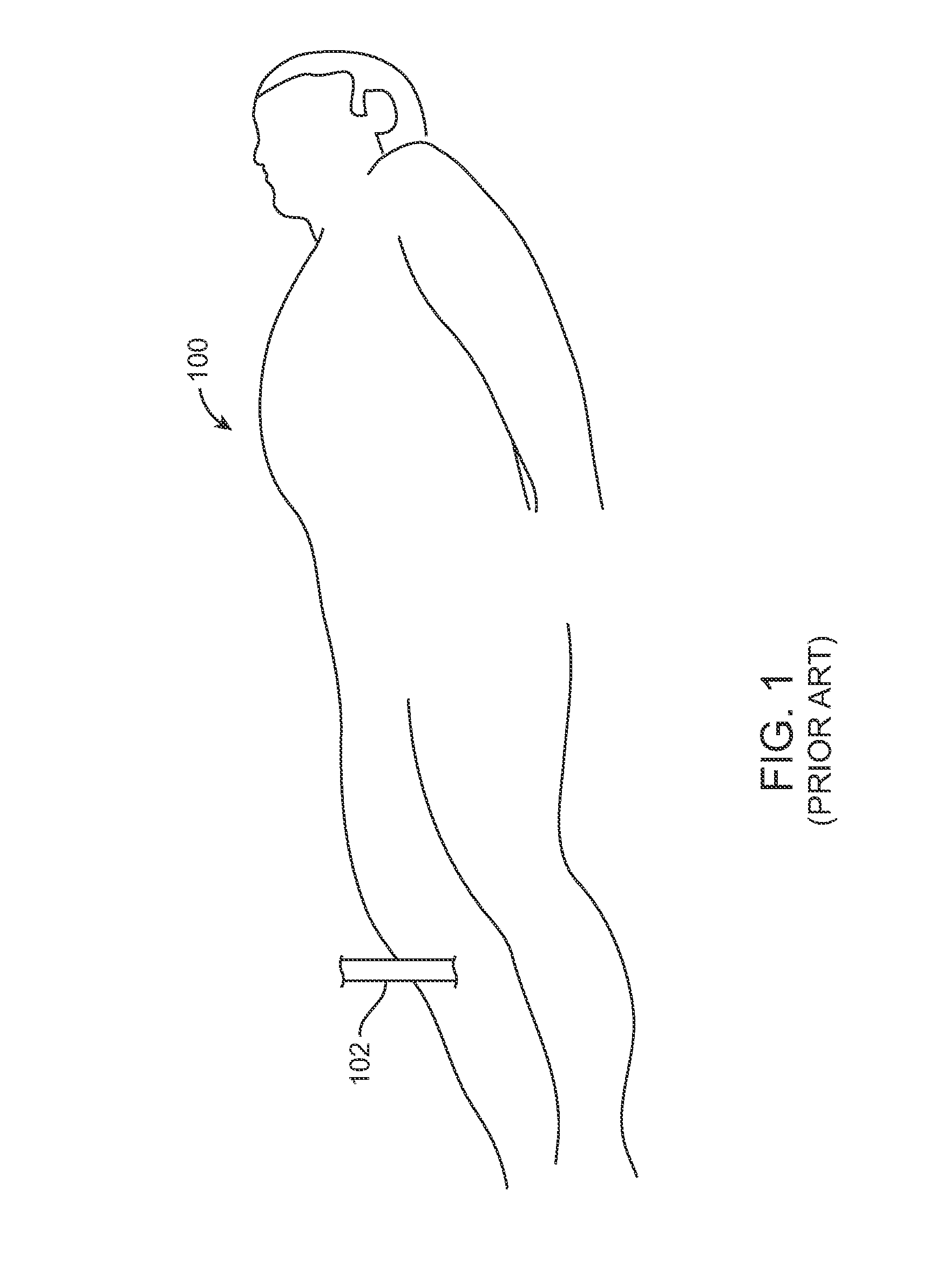 Suturing Device and Method for Sealing an Opening in a Blood Vessel or Other Biological Structure