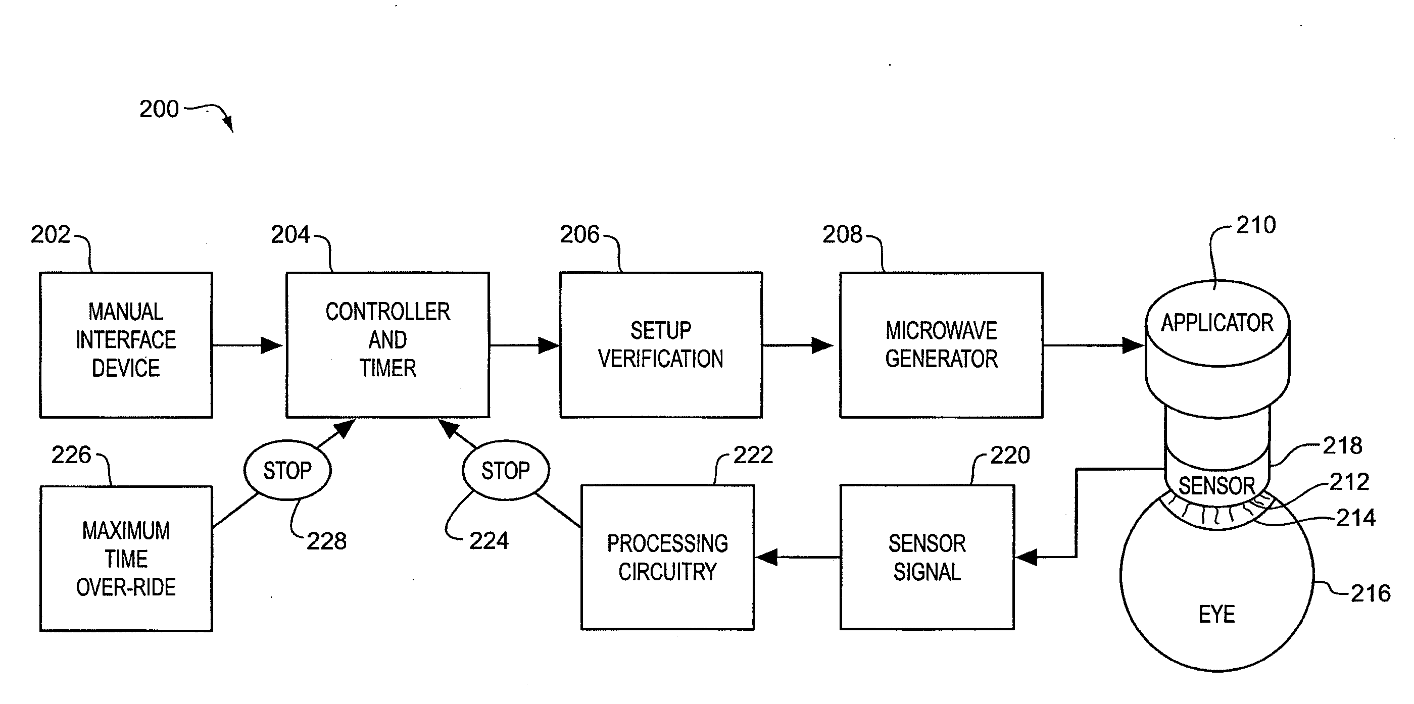 Thermokeratoplasty Systems