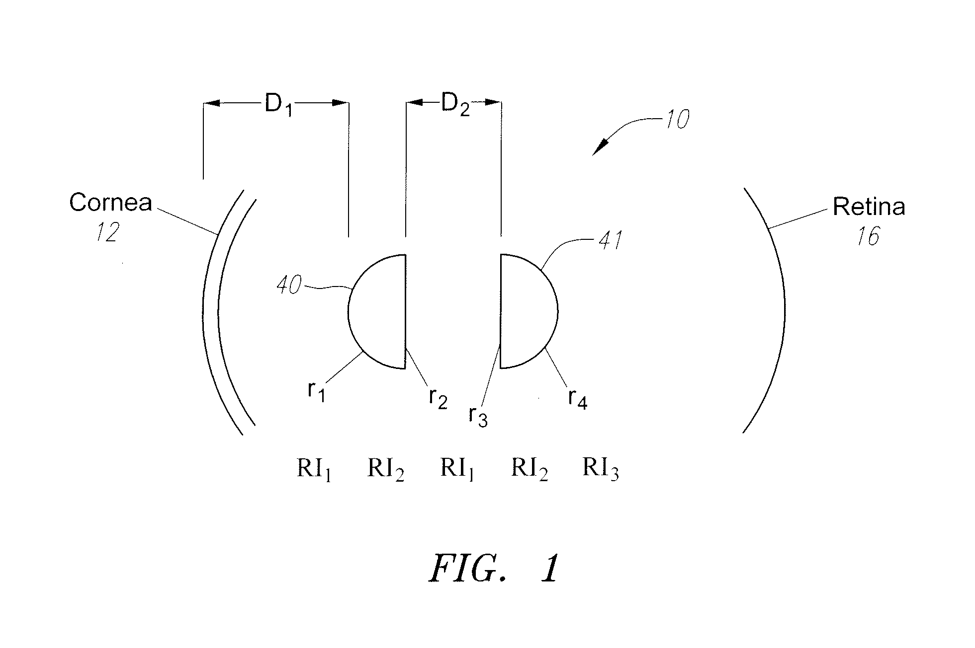 Multiocular Intraocular Lens System