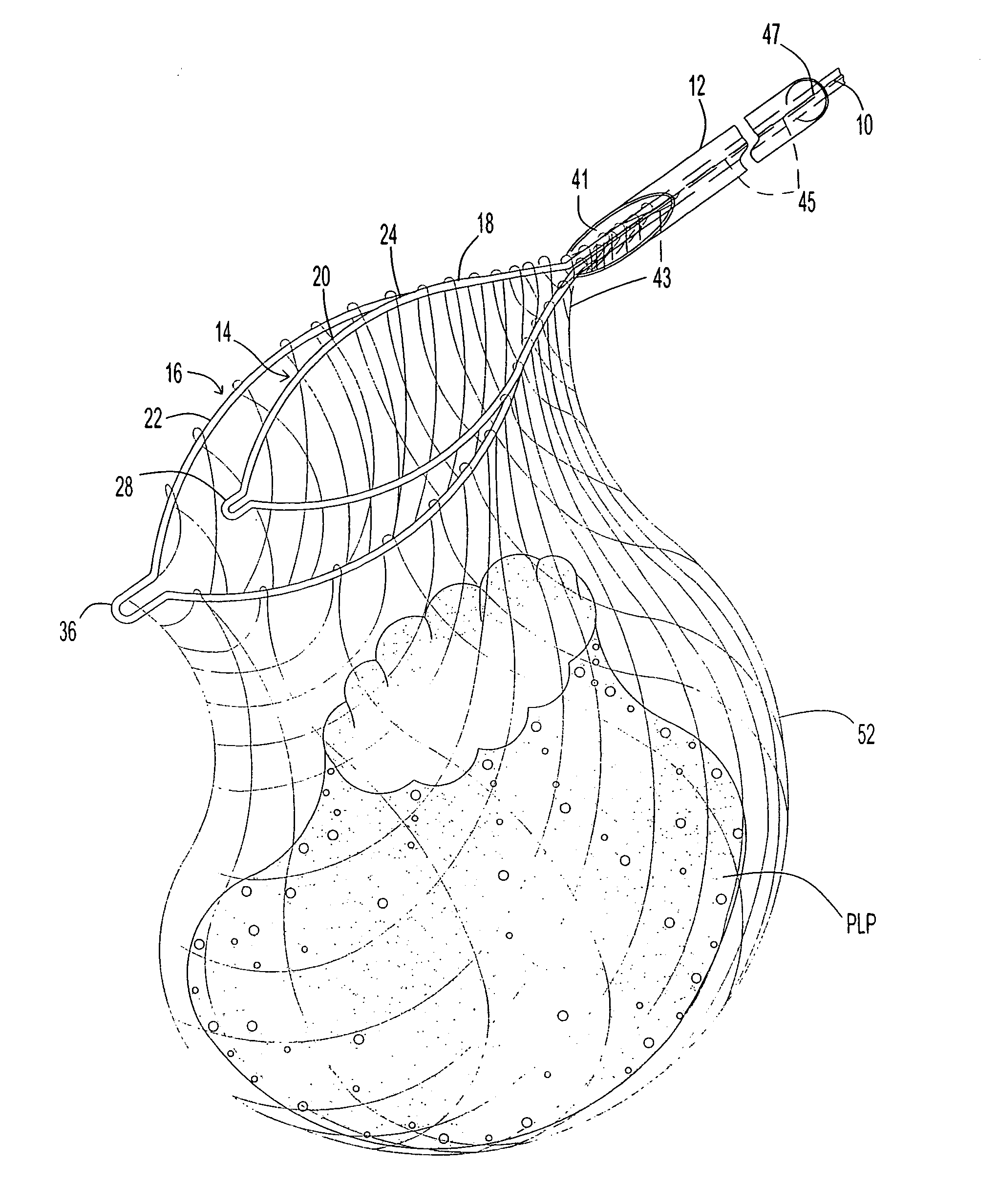 Endoscope cutting and retrieving snare instrument