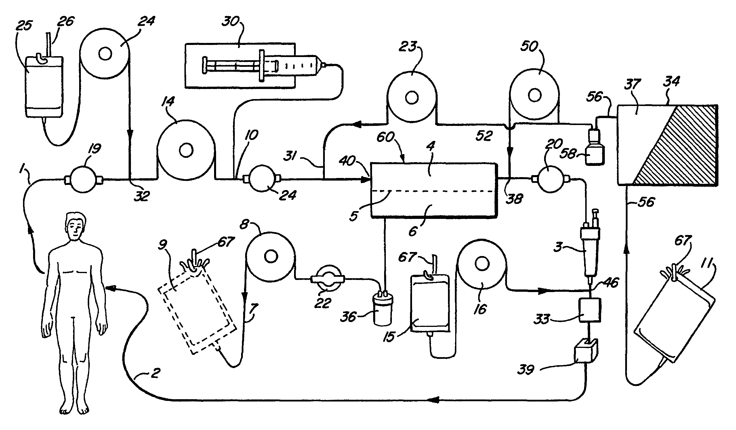 Citrate anticoagulation system for extracorporeal blood treatments