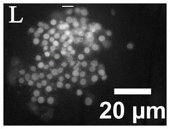 Double staining method for bovine in-vitro fertilization blastocyst