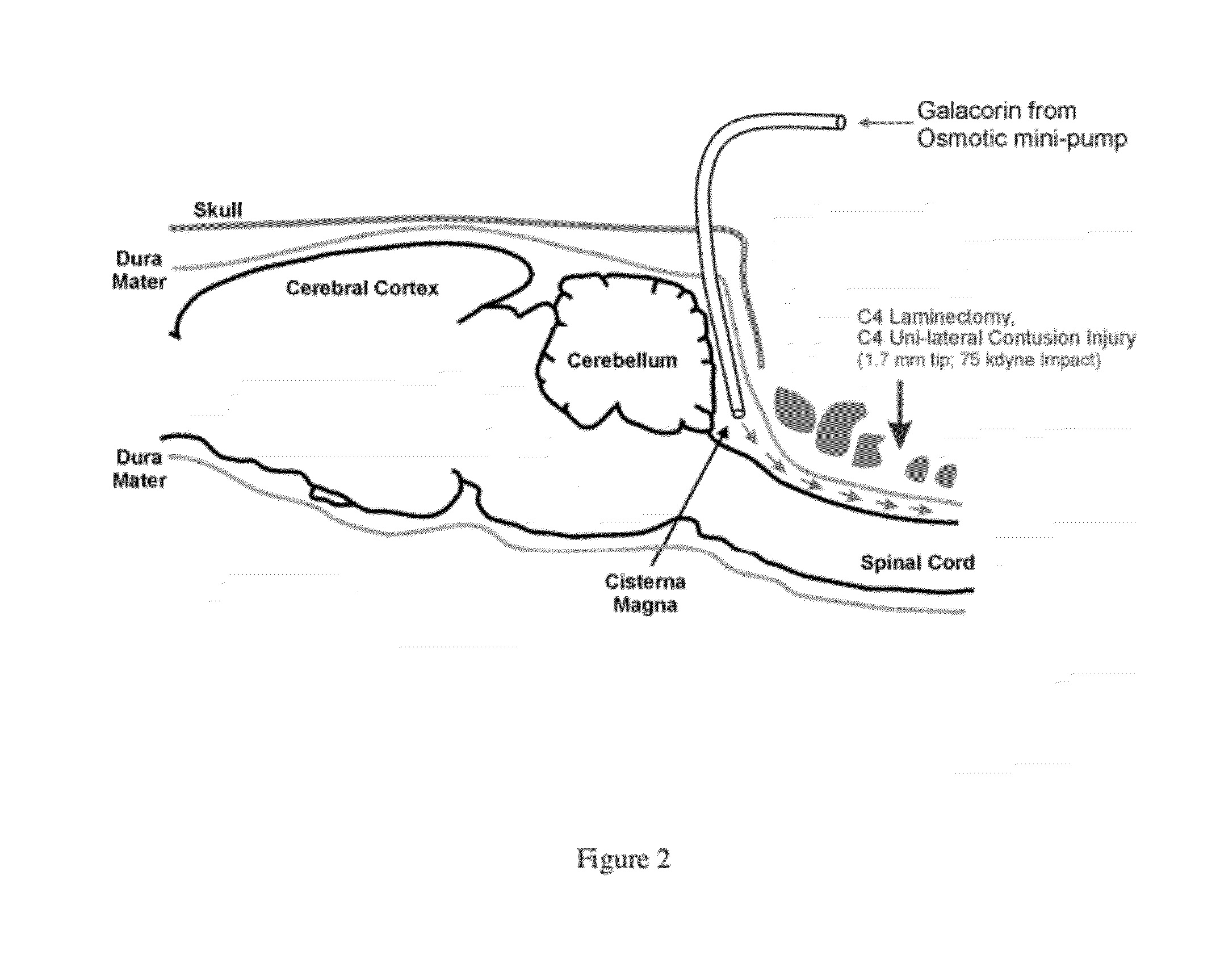 Methods for treating neurological conditions and compositions and materials therefor