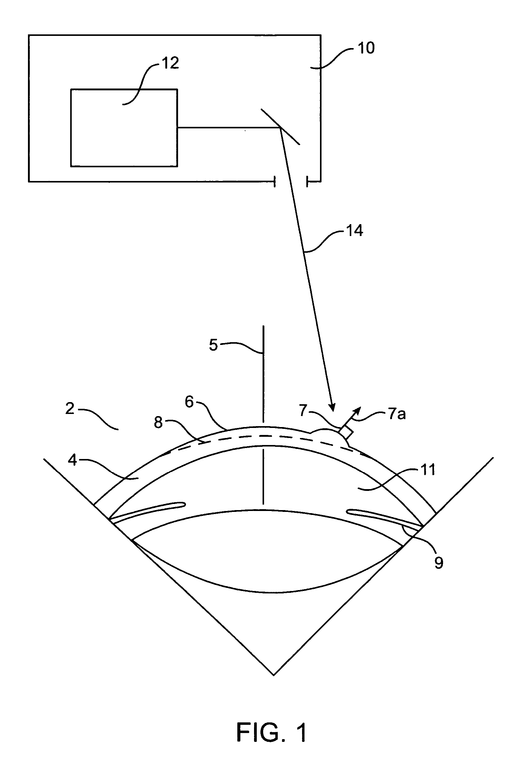 Corneal topography-based target warping system