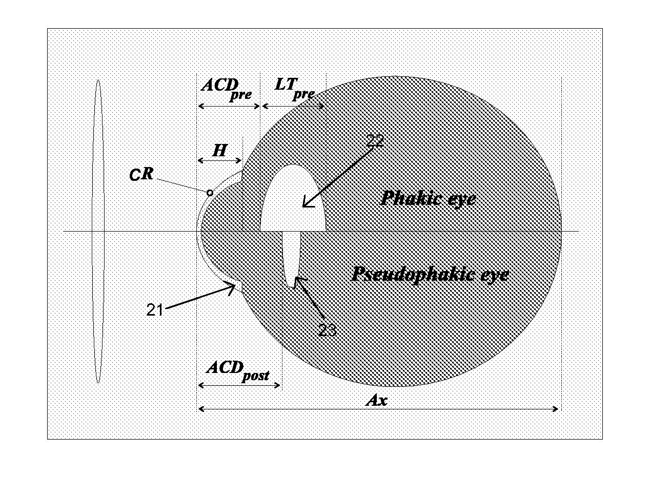 System and Method for Determining and Predicting IOL Power in Situ