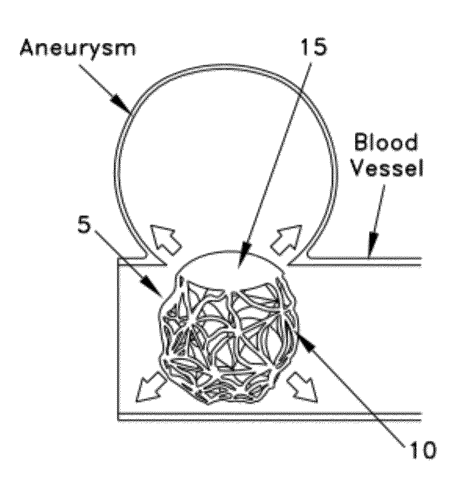 Method and apparatus for restricting flow through an opening in the side wall of a body lumen, and/or for reinforcing a weakness in the side wall of a body lumen, while still maintaining substantially normal flow through the body lumen