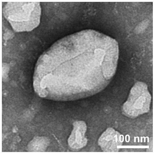 Polypeptide, anti-tumor drug made from polypeptide and preparation method of anti-tumor drug