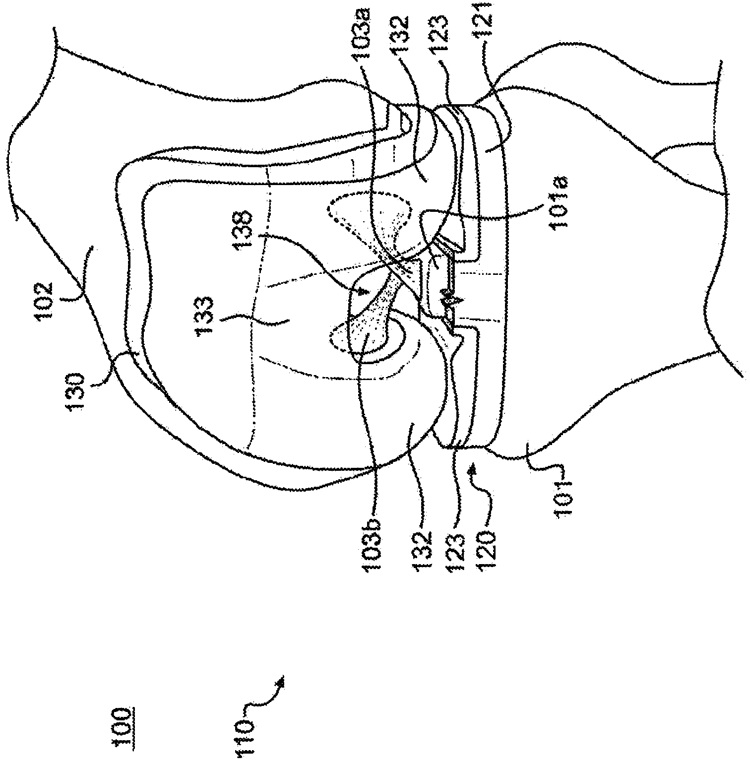 Cruciate-retaining tibial prosthesis