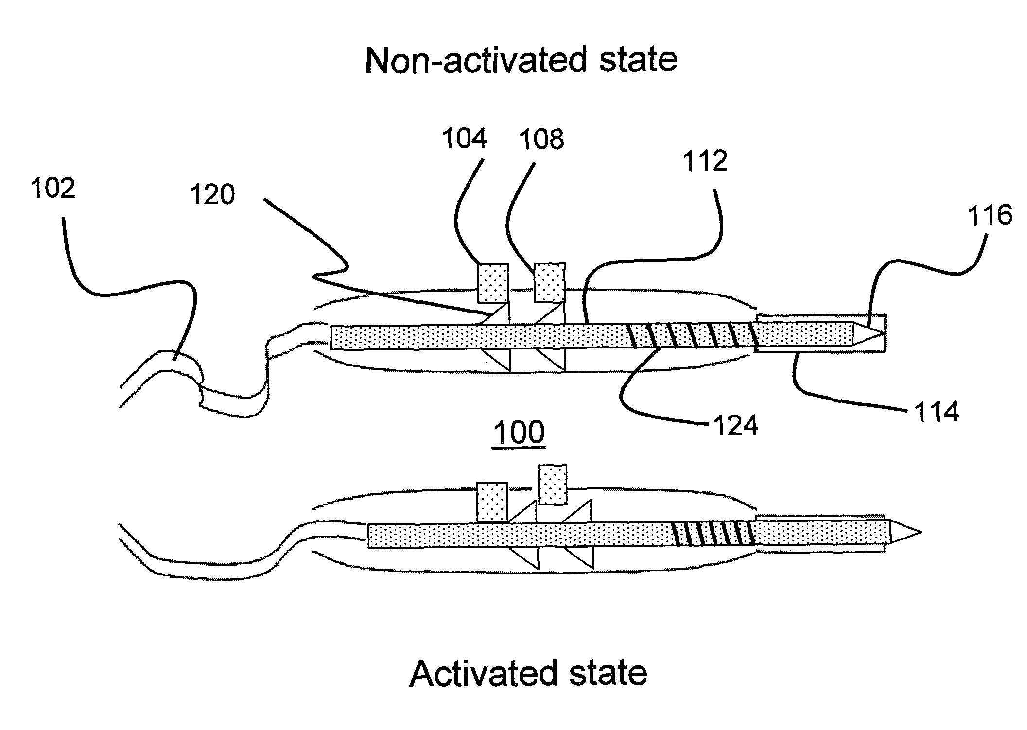 Automatically retracting needle-tip electrocautery device