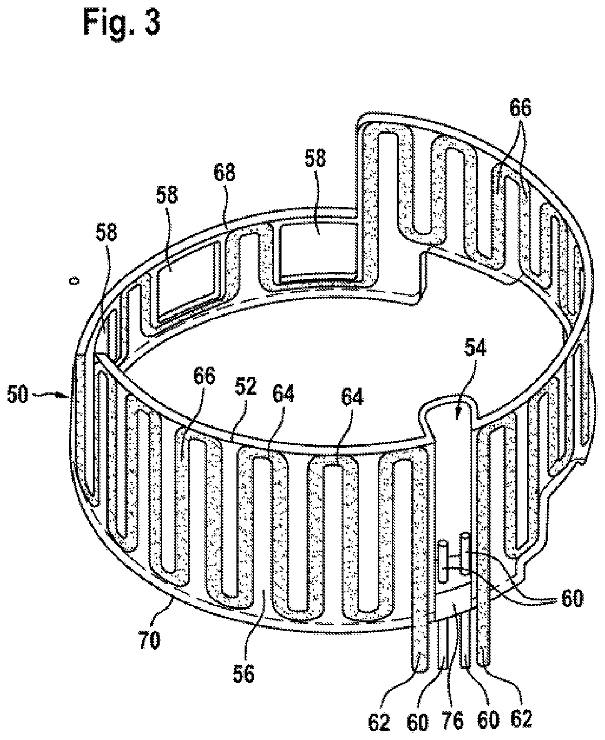 Supply module having a heating device for conveying an operating/auxiliary agent capable of freezing