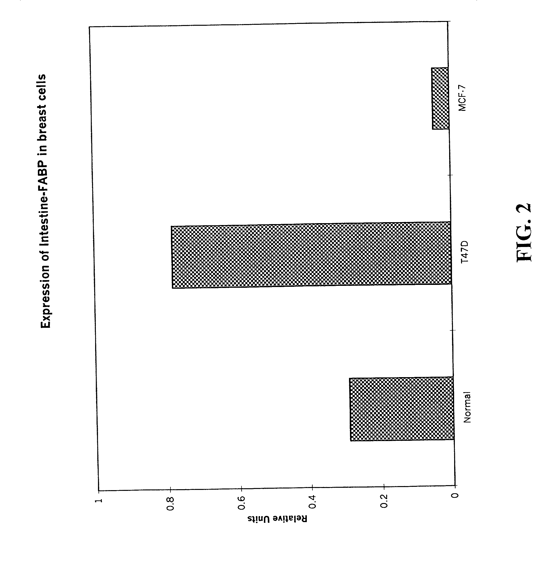 Method of diagnosing stage or aggressiveness of breast and prostate cancer based on levels of fatty acid binding proteins