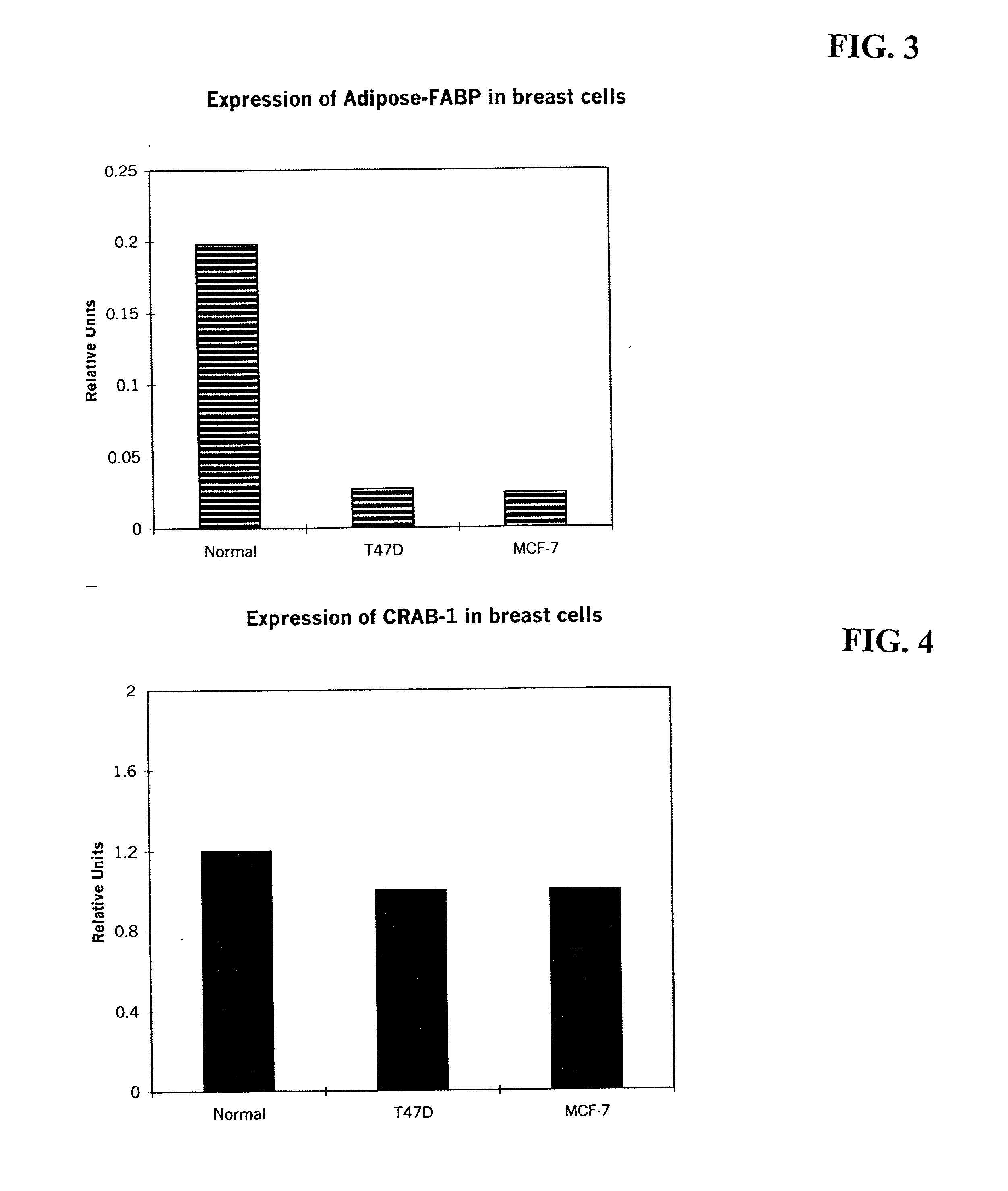 Method of diagnosing stage or aggressiveness of breast and prostate cancer based on levels of fatty acid binding proteins