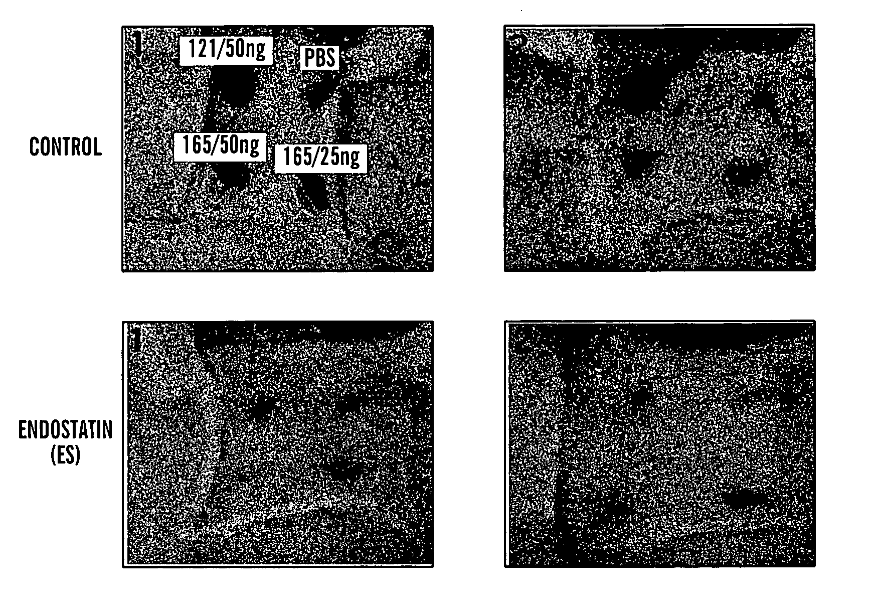 Methods for inhibiting vascular permeability