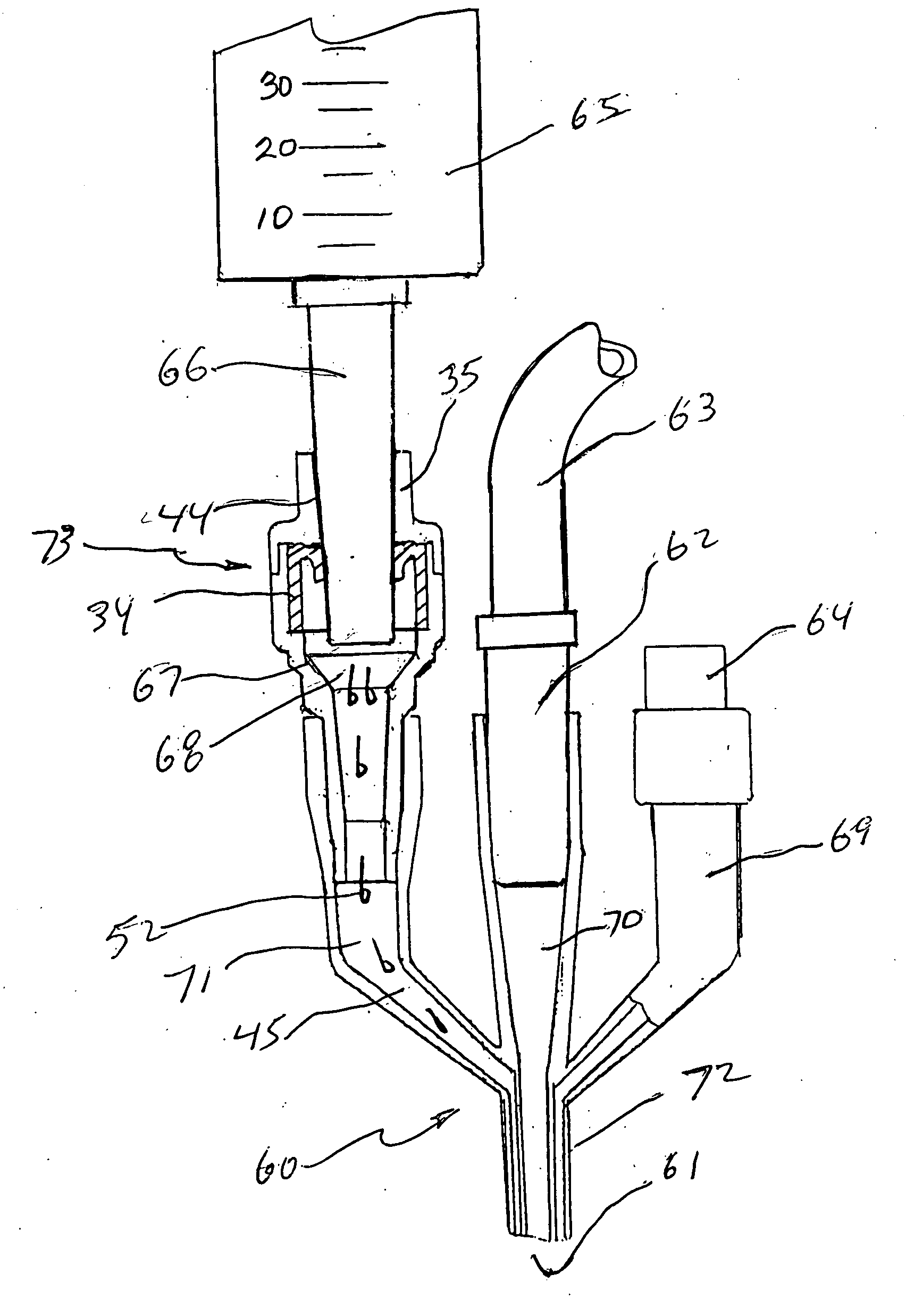 Closed system irrigation connector for urinary catheters