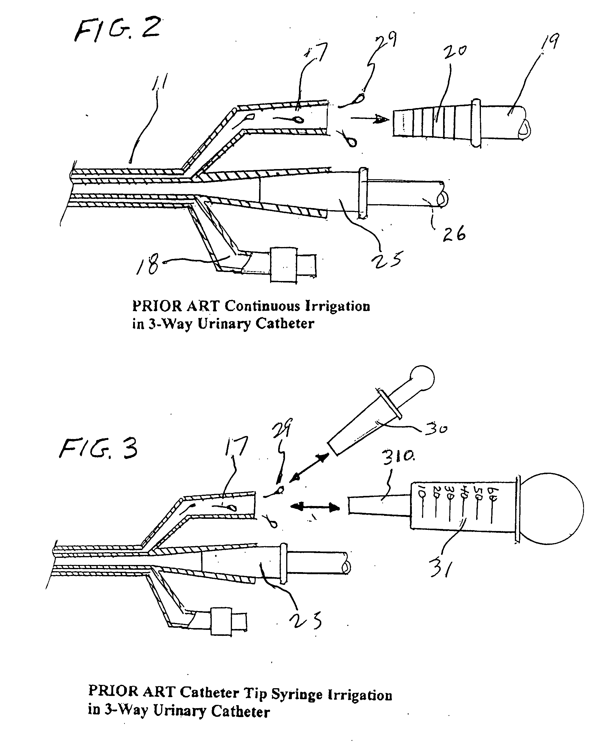 Closed system irrigation connector for urinary catheters