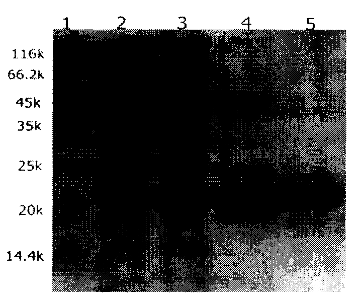 Recombinant plancenta hominis globin renaturation and medicine application protecting alcoholic hepatic injury thereof